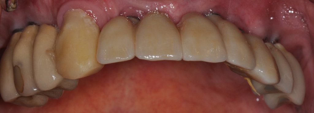 Clinical case kisch 1024x370