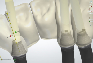Clinical case kisch2