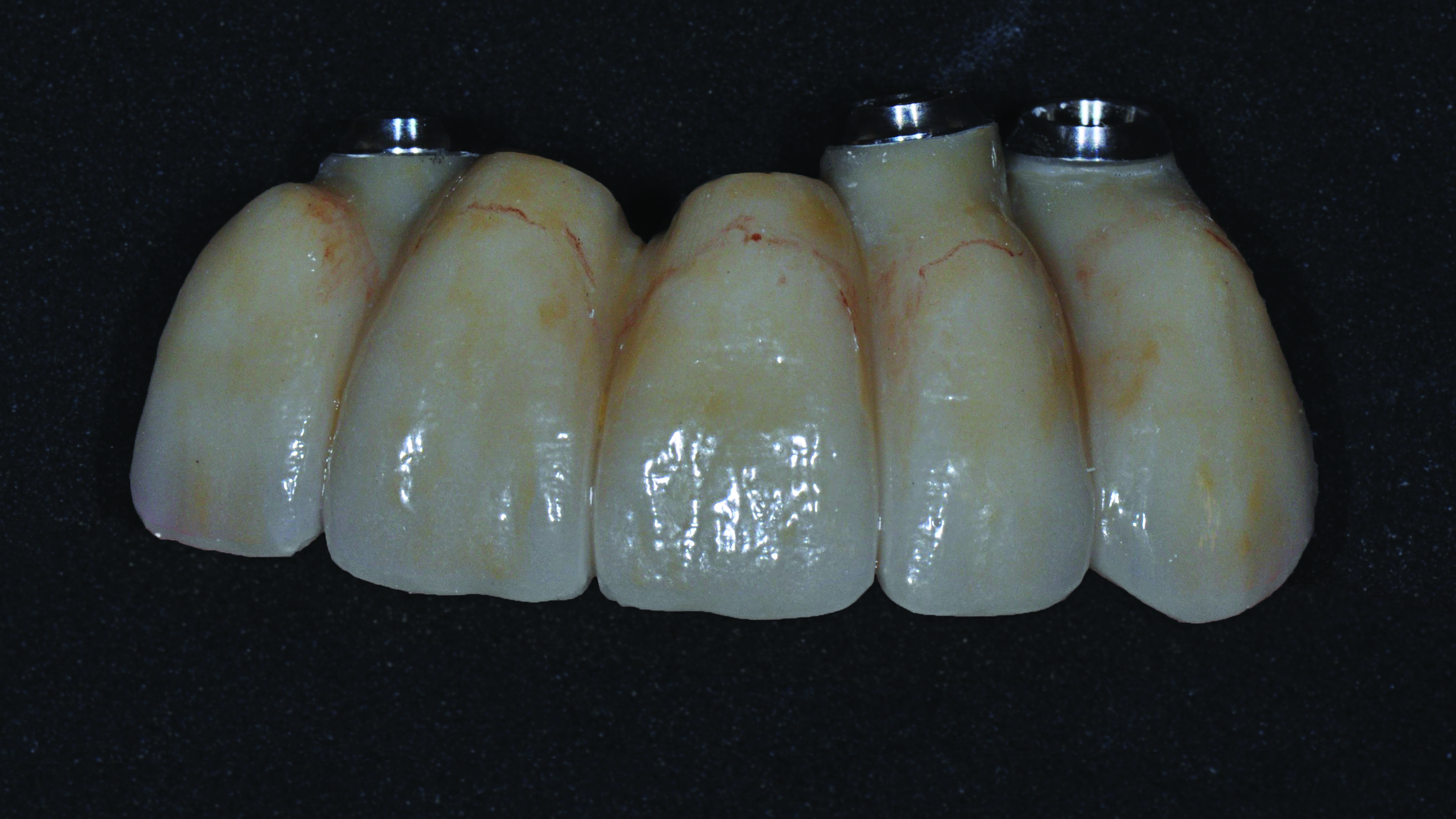 Clinical case kisch3